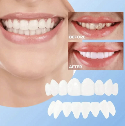Solai™ Clip-On Veneer